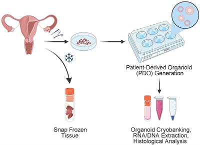 Establishing patient-derived organoids from human endometrial cancer and normal endometrium